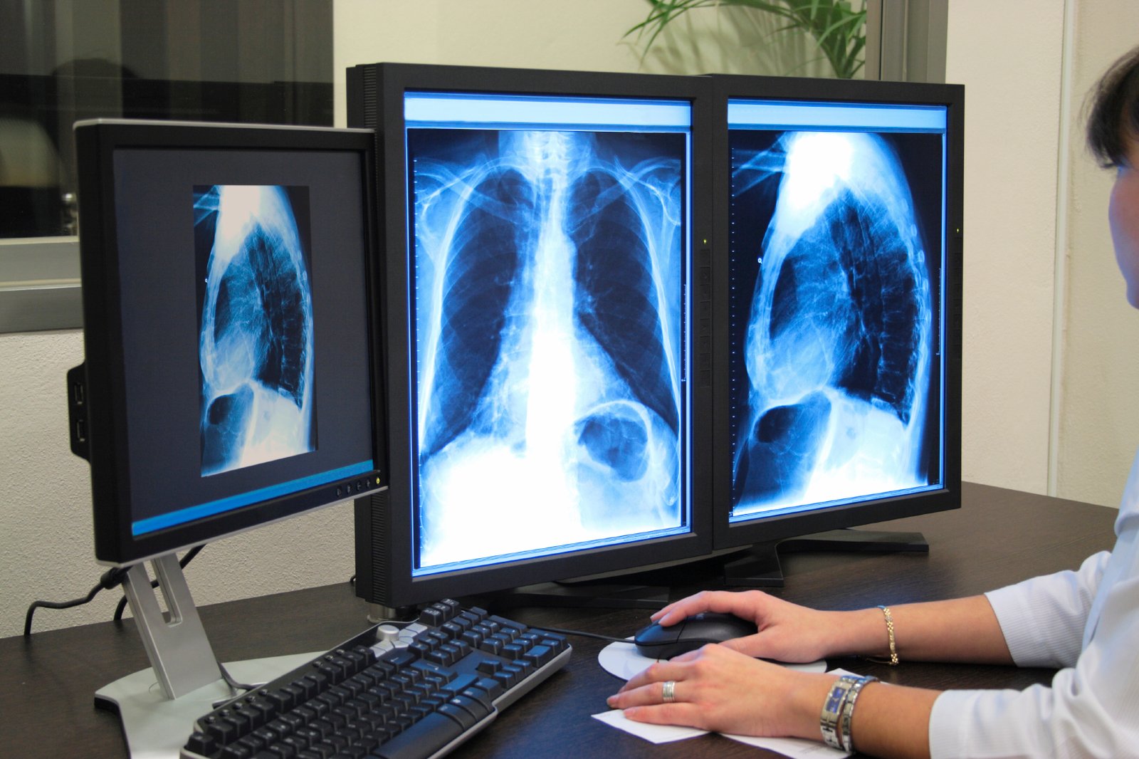 Radiologia Geral Digital Radiológica Rs Diagnóstico Por Imagem 4130